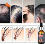 Caffeine Anti-Hairloss Shampoo & Serum Treatment Kit