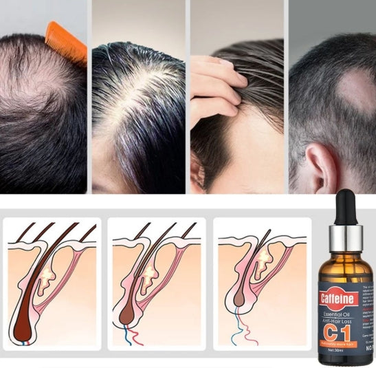 Caffeine Anti-Hairloss Shampoo & Serum Treatment Kit